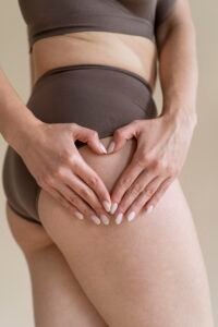 Tratamento para Estrias Curci estética e beleza